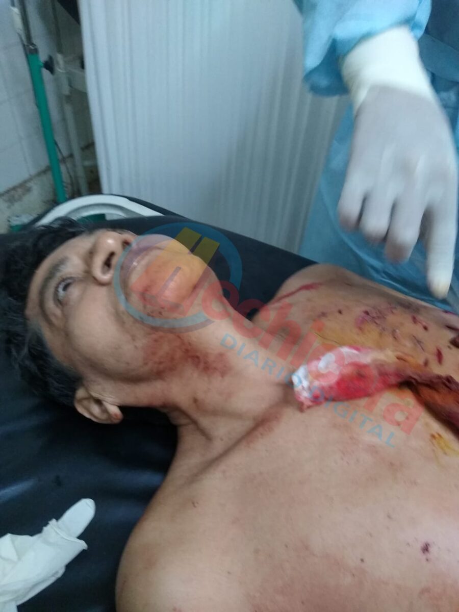 Sujeto intentó asesinar a puñaladas a ex pareja al interior de su casa