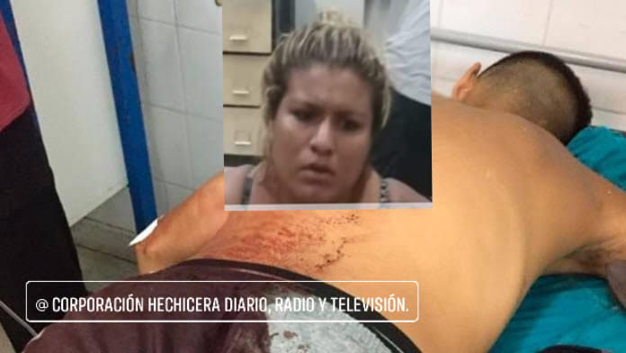 Alias «Nena» apuñala a su conviviente