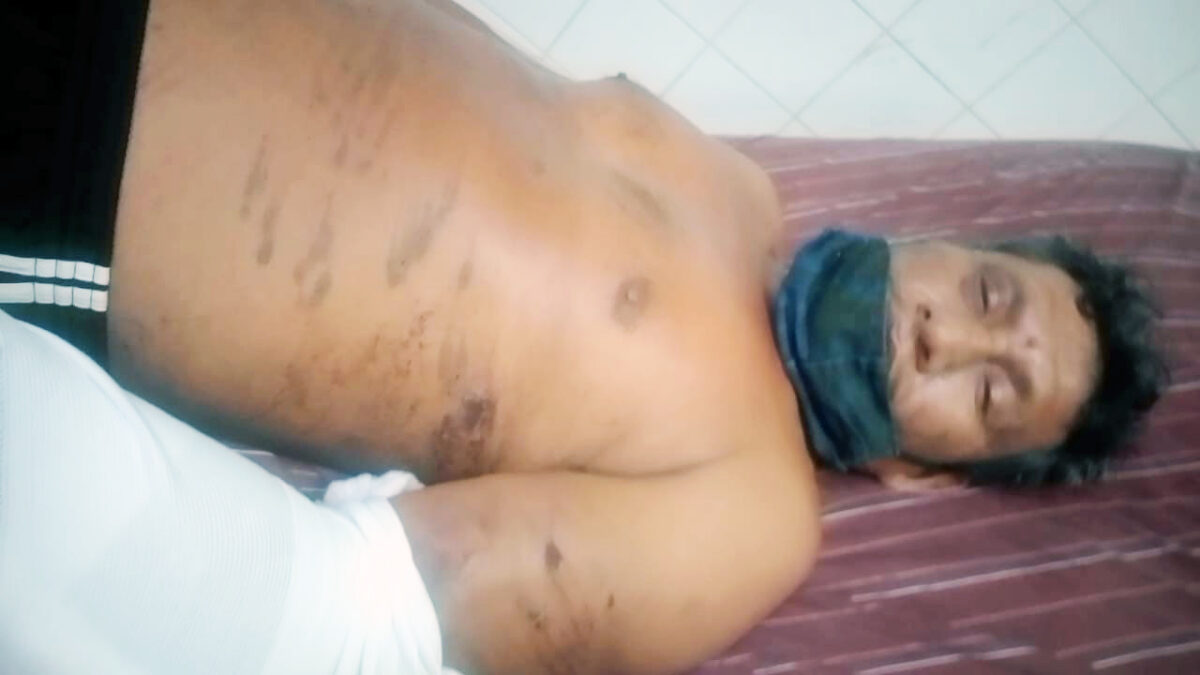 Sujeto masacrado debe ser hospitalizado en un nosocomio de mayor complejidad