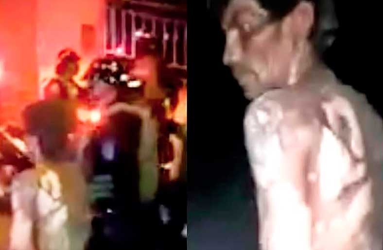Murió hombre que resultó quemado en el interior de una cabaña