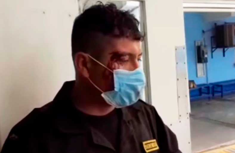 Sereno de la MPT terminó con la ceja rota