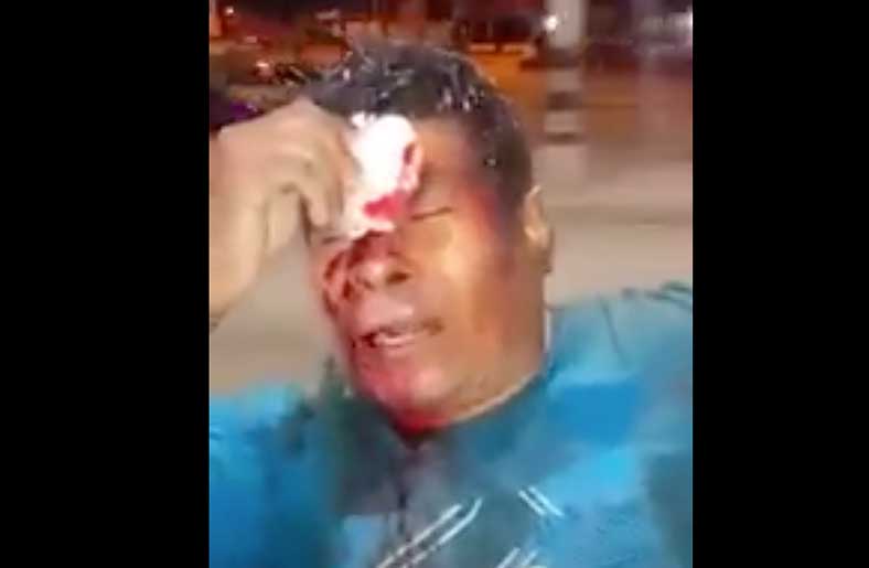 Una persona resultó herida al precipitarse con su moto hacia un canal de regadío