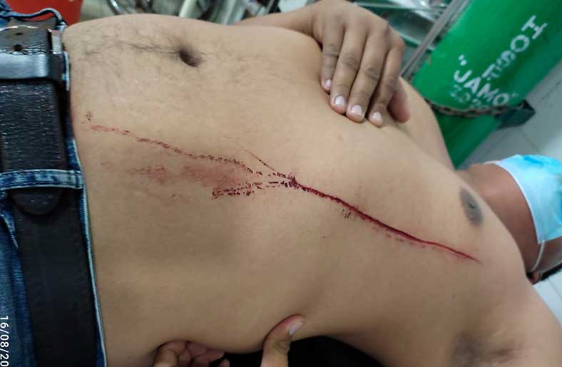 Pelea por pasajeros casi termina en tragedia en Tumbes