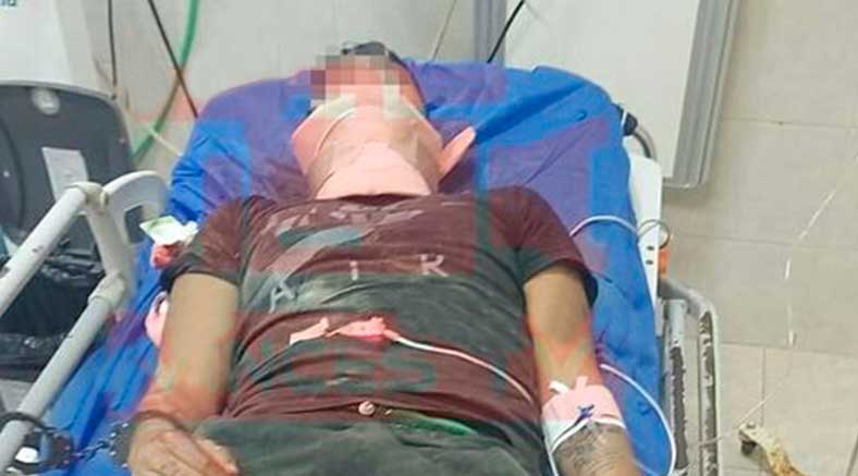Sujeto recibió un balazo en el rostro en la frontera