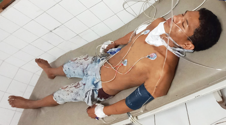 A cuchilladas lo dejan al borde de la muerte en el barrio San José