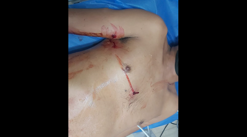 Balean a sujeto en el filo del Canal Internacional