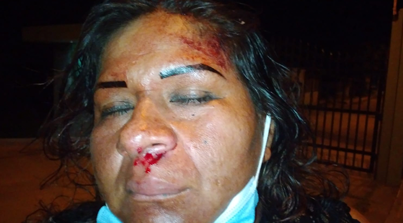Pareja de esposos acusa a “la gata” de brutal ataque