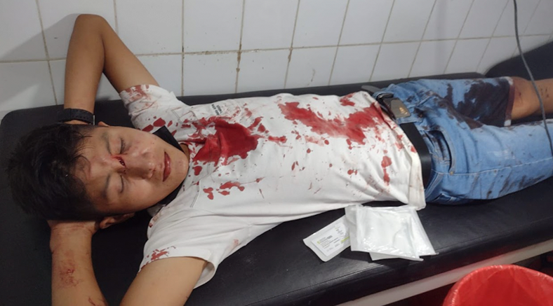 Cuatro heridos en terrible accidente frente a la Universidad de Tumbes