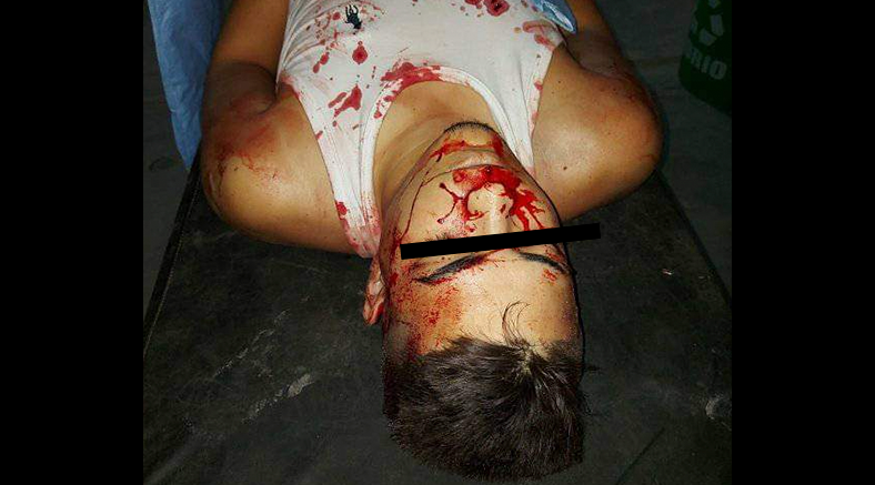 Acribillan de varios disparos a venezolano en Zarumilla