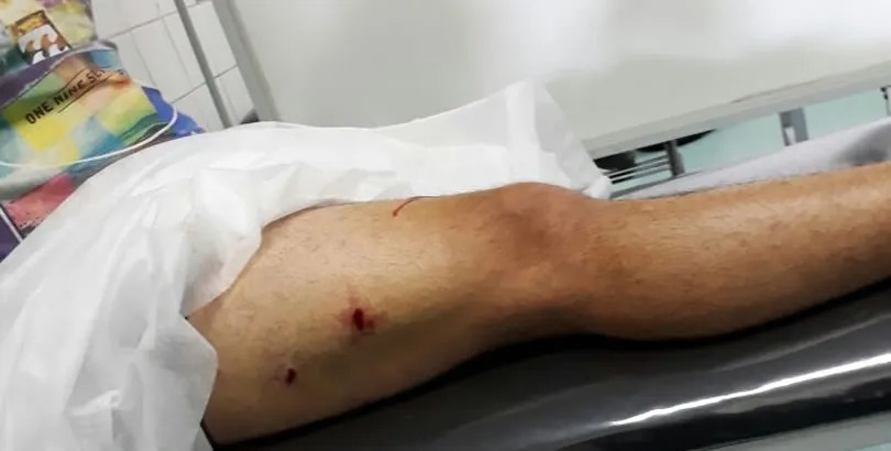 PERUANO SE ENFRENTA A BALAZOS A LA POLICÍA ECUATORIANA PARA EVITAR SER DETENIDO